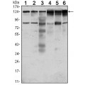 anti-HYAL1 antibody (Hyaluronidase-1) (N-Term)