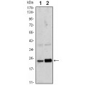 anti-HYAL1 antibody (Hyaluronidase-1) (N-Term)