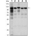 anti-HYAL1 antibody (Hyaluronidase-1) (N-Term)