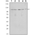 anti-HYAL1 antibody (Hyaluronidase-1) (N-Term)