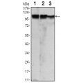 anti-HYAL1 antibody (Hyaluronidase-1) (N-Term)
