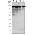 anti-HYAL1 antibody (Hyaluronidase-1) (N-Term)