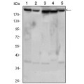 anti-HYAL1 antibody (Hyaluronidase-1) (N-Term)