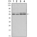 anti-HYAL1 antibody (Hyaluronidase-1) (N-Term)