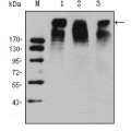 anti-HYAL1 antibody (Hyaluronidase-1) (N-Term)