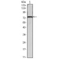 anti-HYAL1 antibody (Hyaluronidase-1) (N-Term)