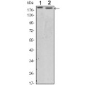 anti-HYAL1 antibody (Hyaluronidase-1) (N-Term)