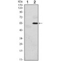 anti-HYAL1 antibody (Hyaluronidase-1) (N-Term)