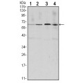 anti-HYAL1 antibody (Hyaluronidase-1) (N-Term)