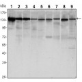 anti-HYAL1 antibody (Hyaluronidase-1) (N-Term)