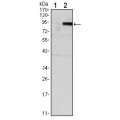 anti-HYAL1 antibody (Hyaluronidase-1) (N-Term)