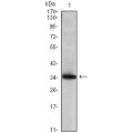 anti-HYAL1 antibody (Hyaluronidase-1) (N-Term)
