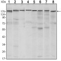 anti-HYAL1 antibody (Hyaluronidase-1) (N-Term)