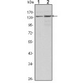anti-HYAL1 antibody (Hyaluronidase-1) (N-Term)
