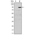 anti-HYAL1 antibody (Hyaluronidase-1) (N-Term)