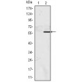 anti-HYAL1 antibody (Hyaluronidase-1) (N-Term)