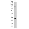 anti-HYAL1 antibody (Hyaluronidase-1) (N-Term)
