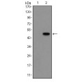 anti-HYAL1 antibody (Hyaluronidase-1) (N-Term)