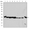 anti-HYAL1 antibody (Hyaluronidase-1) (N-Term)