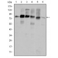 anti-HYAL1 antibody (Hyaluronidase-1) (N-Term)