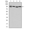 anti-HYAL1 antibody (Hyaluronidase-1) (N-Term)
