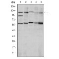 anti-HYAL1 antibody (Hyaluronidase-1) (N-Term)