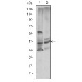 anti-HYAL1 antibody (Hyaluronidase-1) (N-Term)