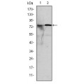 anti-HYAL1 antibody (Hyaluronidase-1) (N-Term)