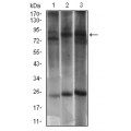 anti-HYAL1 antibody (Hyaluronidase-1) (N-Term)