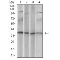 anti-HYAL1 antibody (Hyaluronidase-1) (N-Term)