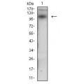 anti-HYAL1 antibody (Hyaluronidase-1) (N-Term)