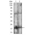 anti-HYAL1 antibody (Hyaluronidase-1) (N-Term)
