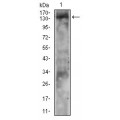 anti-HYAL1 antibody (Hyaluronidase-1) (N-Term)