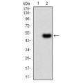 anti-HYAL1 antibody (Hyaluronidase-1) (N-Term)