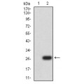 anti-HYAL1 antibody (Hyaluronidase-1) (N-Term)