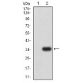 anti-HYAL1 antibody (Hyaluronidase-1) (N-Term)