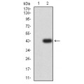 anti-HYAL1 antibody (Hyaluronidase-1) (N-Term)