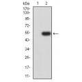 anti-HYAL1 antibody (Hyaluronidase-1) (N-Term)