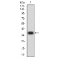 anti-HYAL1 antibody (Hyaluronidase-1) (N-Term)