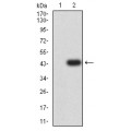 anti-HYAL1 antibody (Hyaluronidase-1) (N-Term)