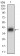 FSHB Primary Antibody MP30640 [M3C1E4]