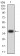RB1CC1 Primary Antibody  MP31717 [M2C9A11]