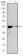 ACTA2 Primary Antibody MP30163 [M4F4]