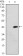 ATM Primary Antibody MP30173 [M5C5]