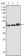 CK17 Primary Antibody MP20363 [M3B12]