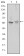 ABCG2 Primary Antibody MP30216 [M3G8]
