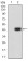 ACSS1 Primary Antibody MP31681  [M3A7C1]