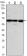 ESR1 Primary Antibody MP30099 [M6B6]