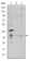 CD1A Primary Antibody MP30185 [M6H3]