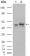 Calreticulin Primary Antibody MP20181 [M1G6A7]